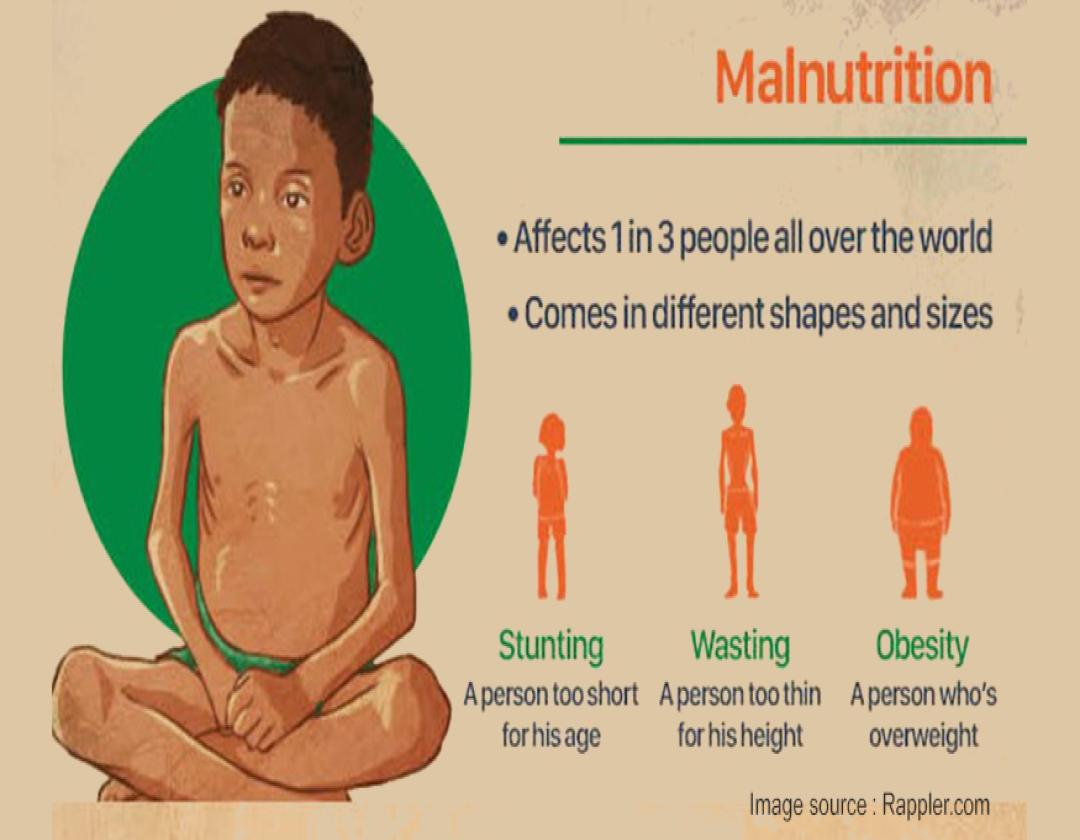 Malnutition cases increase at Fort Portal Regional Referral Hospital