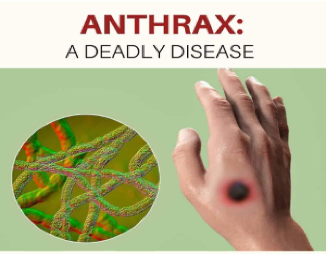 Anthrax Disease kills two people in Kazo