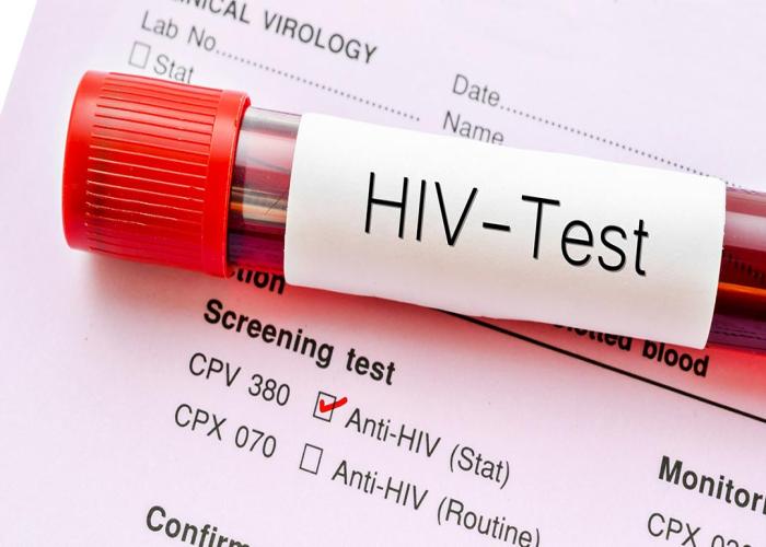 Concern as young girls get infected with AIDS in Mbarara